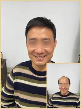 西峡中年男士假发隐形补发中心批发,客户满意再付款