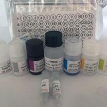人再生胰岛衍生3α;胰石蛋白;胰线蛋白(REG3α)elisa试剂盒