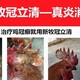 公雞頭上長雞冠癬怎么治療圖