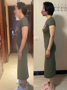 模具CL是什么，效果是真的嗎