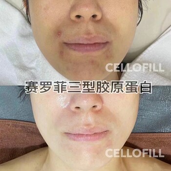 新版加強版帝美妮