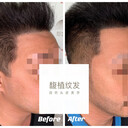 紋發(fā)怎么樣？有什么好的優(yōu)點？