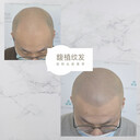紋發(fā)是什么？什么是紋發(fā)