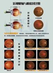 孩子近视太早的解决方法，寻求加盟合作